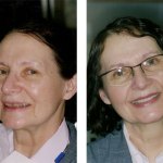 Before and After Dental Treatment