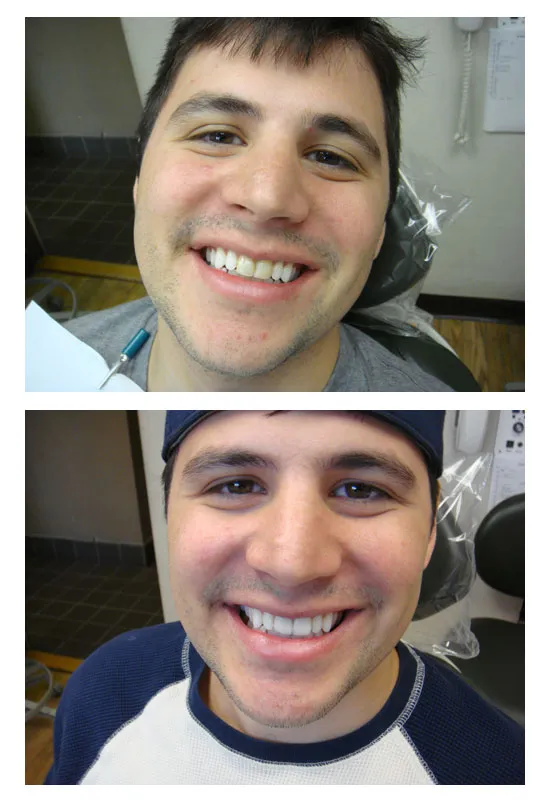 Before and After Dental Treatment