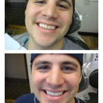 Before and After Dental Treatment