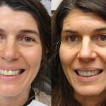 Before and After Dental Treatment